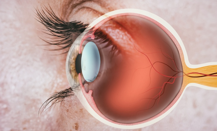 An up-close side view of a patient's eye underneath a semi-translucent animated eye anatomy diagram.